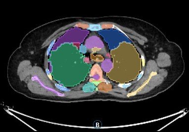 Fused PET/CT viewer