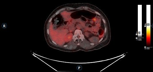 SPECT Vision screenshot